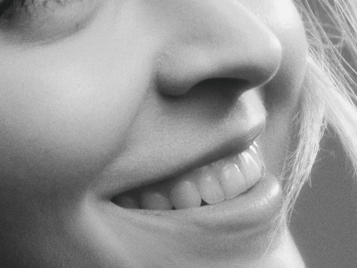 Sonrisa blanca y armónica tras un diseño de sonrisa