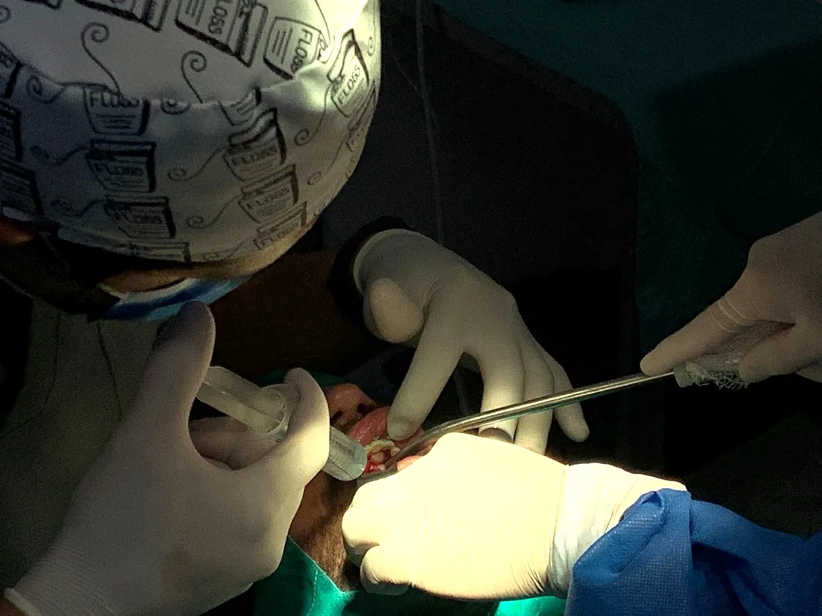 Especialista realizando una cirugía de implante dental